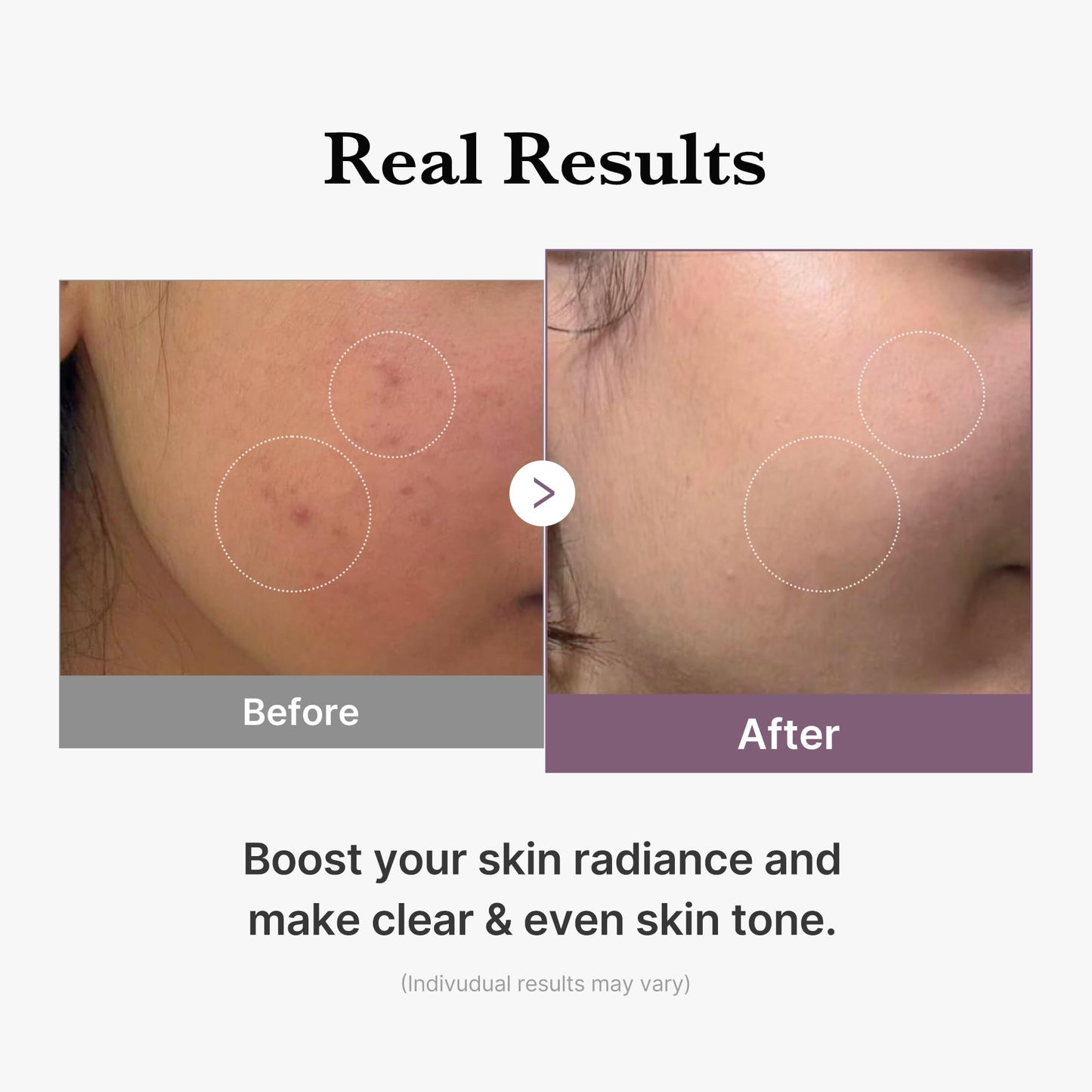 medicube Age-R Glutathione Glow Milky Toner – Glass Skin Hydration & Even Tone