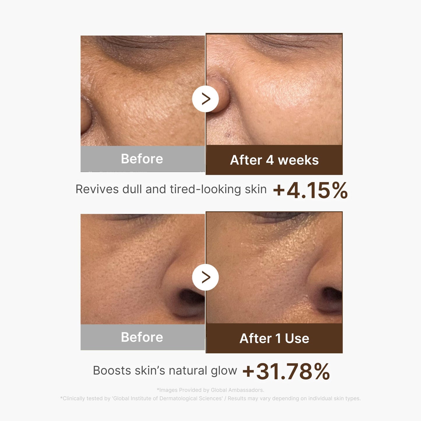 Medicube Deep Vitamin C Capsule Serum | Hydrating Vitamin C Serum for Dull & Uneven Skin | Liposome Capsule Technology | Korean Skincare 1.01 fl oz