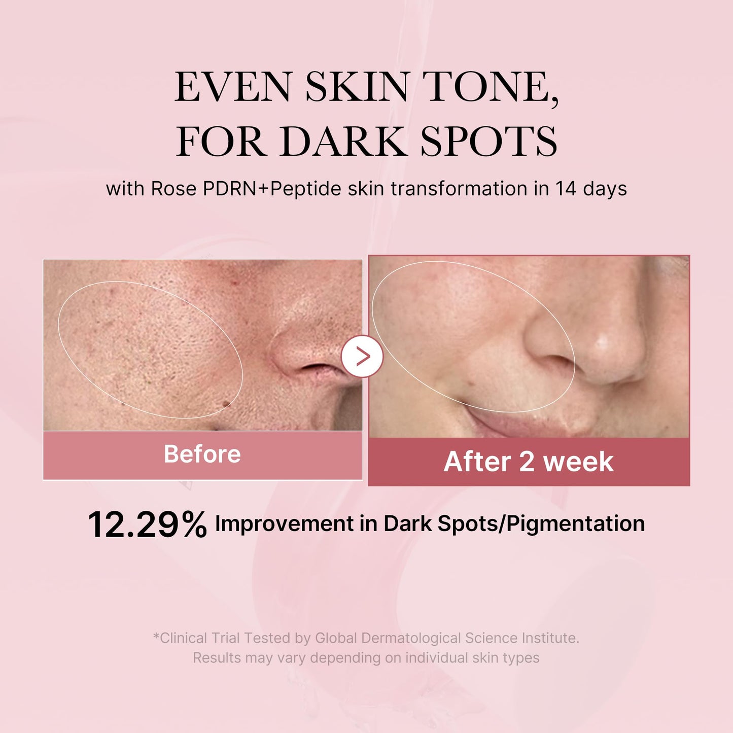 medicube PDRN Toner Rose – Lightweight Rose PDRN Peptide Toner for Radiant, Even Skin Tone | Korean Skincare