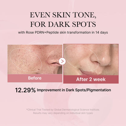 medicube PDRN Toner Rose – Lightweight Rose PDRN Peptide Toner for Radiant, Even Skin Tone | Korean Skincare